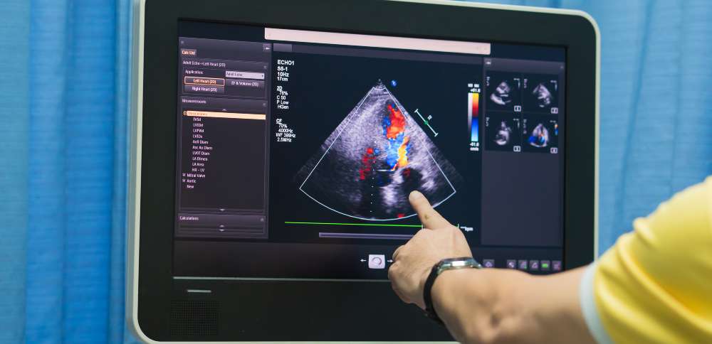 Stay ahead of health issues: Echo Ultrasound's $400 comprehensive body scan
