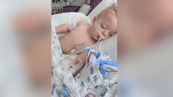 2-year-old twin hospitalized after rescue from fire