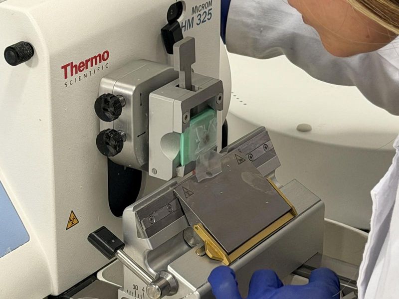 Top World story anchor