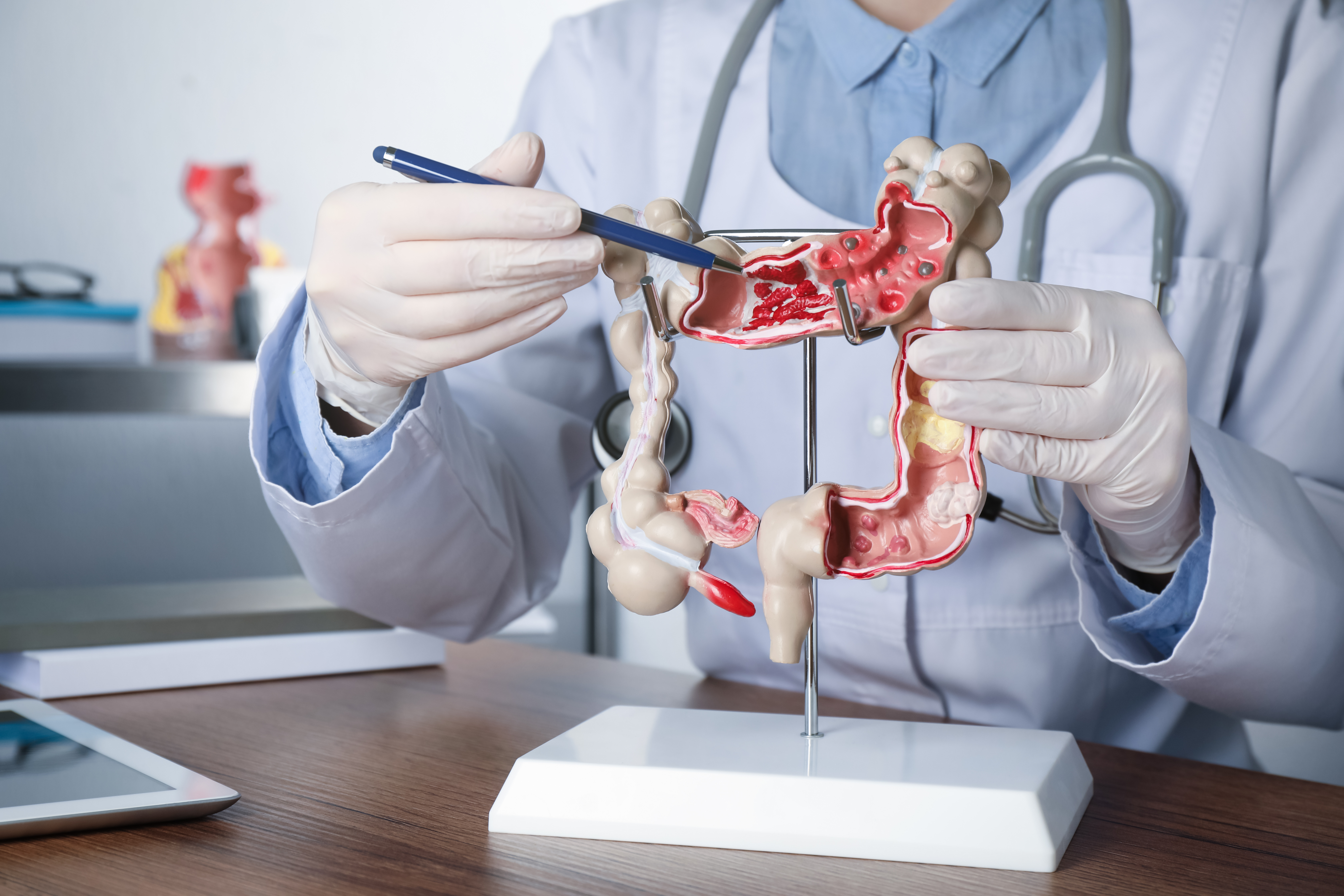 Colon Cancer Leading Cause of Cancer Deaths Under 50: When to See a Doctor and Get a Colonoscopy