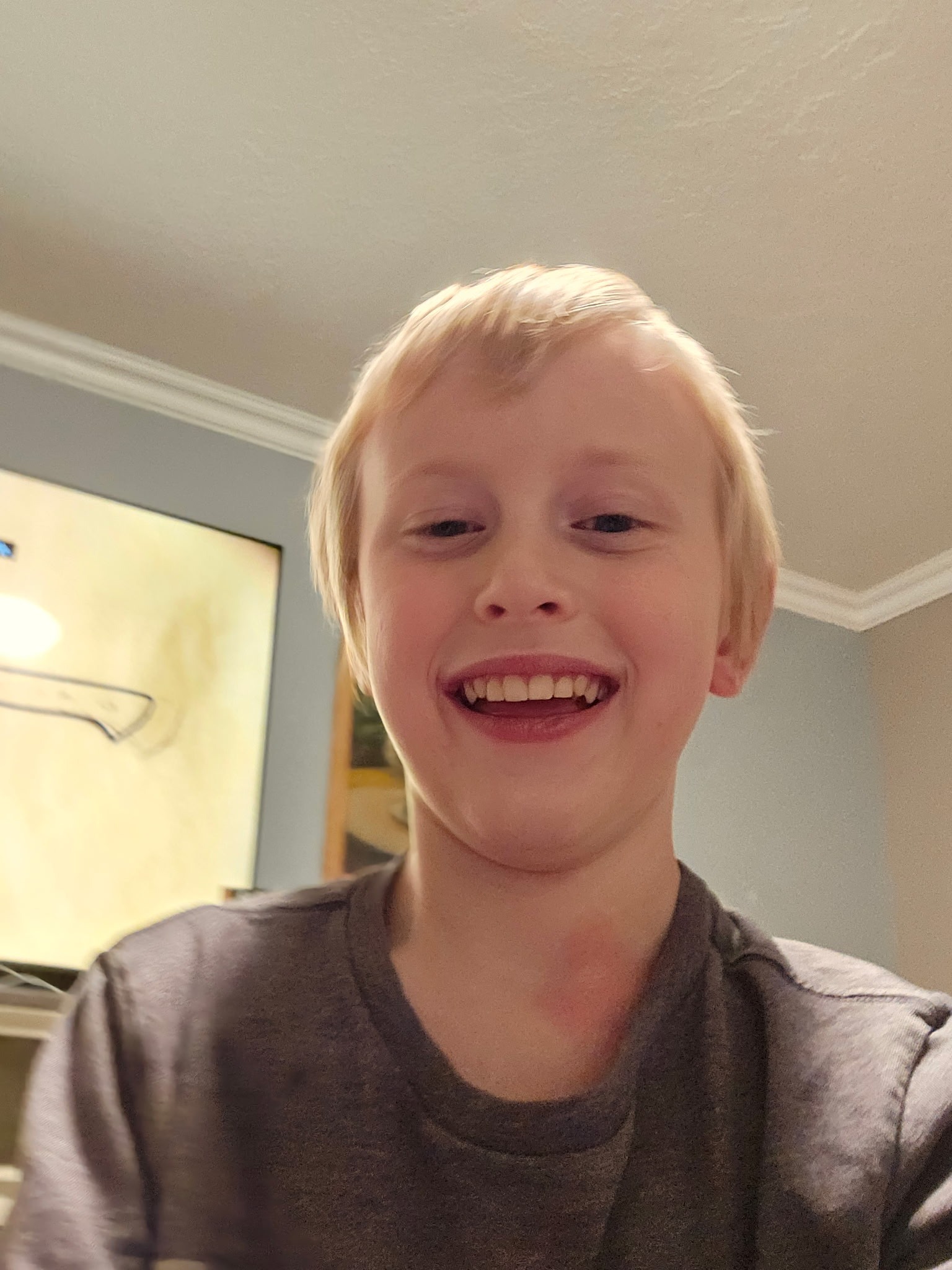 Twelve-year-old Rockwell Gundersen was critically injured when he was hit by a car while on an electric scooter Wednesday in West Jordan