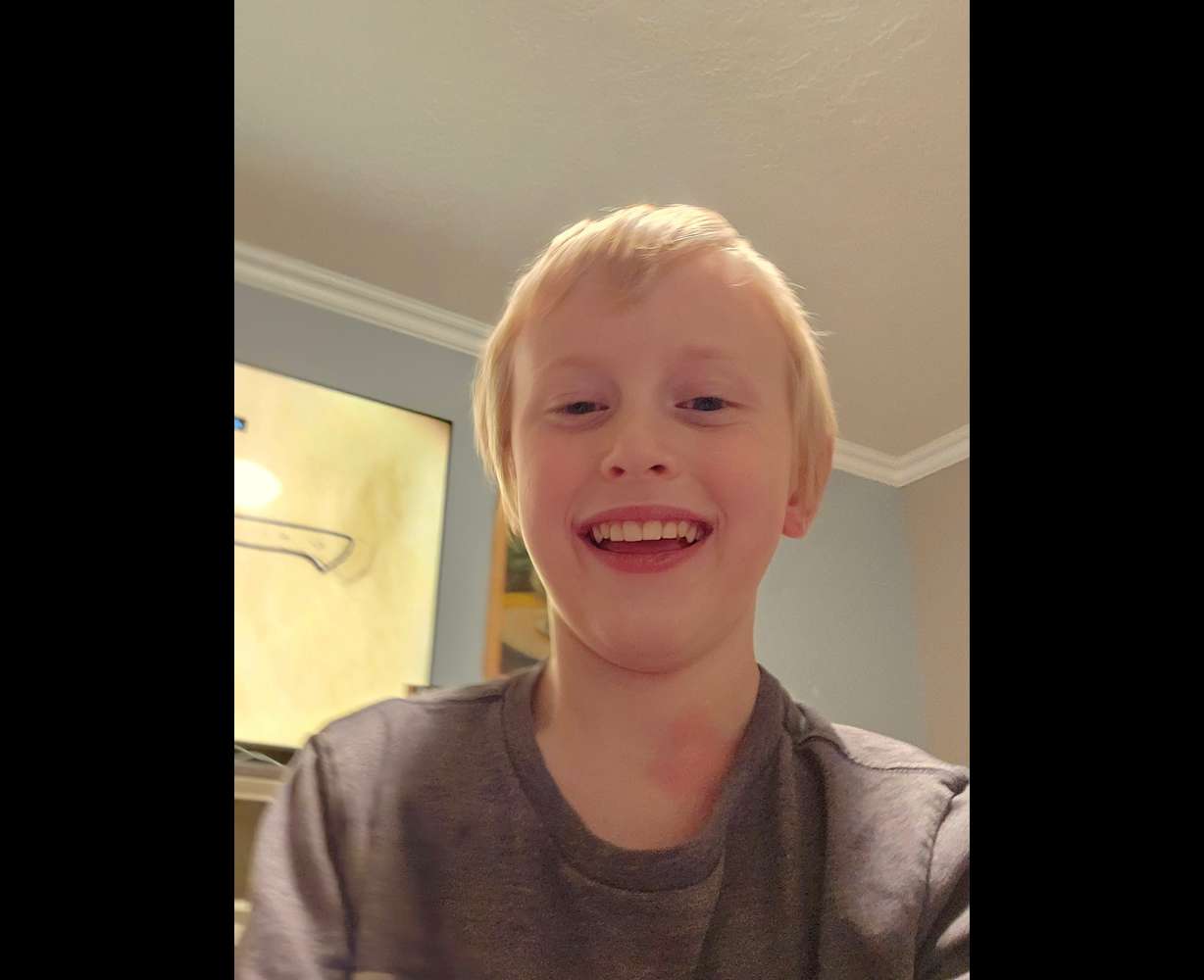 Twelve-year-old Rockwell Gundersen was critically injured when he was hit by a car while on an electric scooter Wednesday in West Jordan