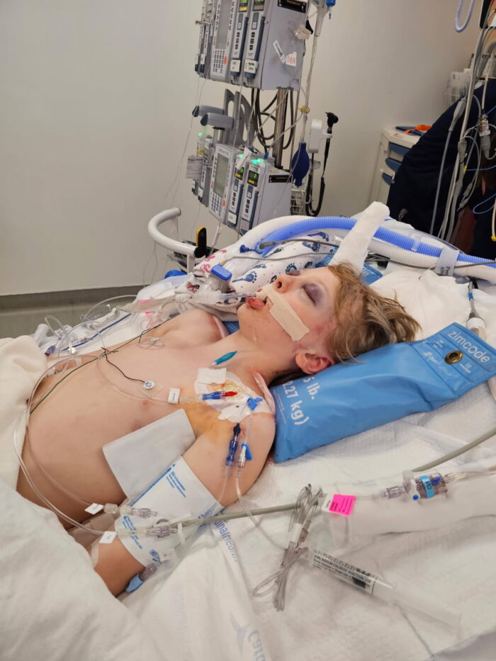 Rockwell Gundersen in the hospital, Wednesday. Rockwell was hit by an SUV while riding an electric scooter in West Jordan.