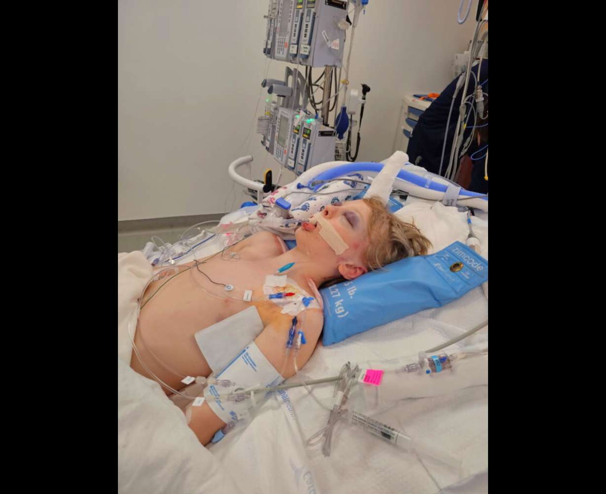 Rockwell Gundersen in the hospital, Wednesday. Rockwell was hit by an SUV while riding an electric scooter in West Jordan.