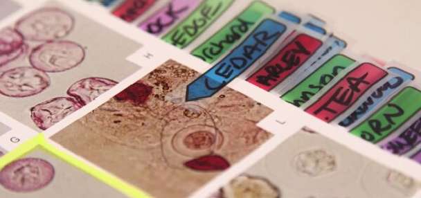 'Buckle up': Allergy season hitting early, and hard, in Utah