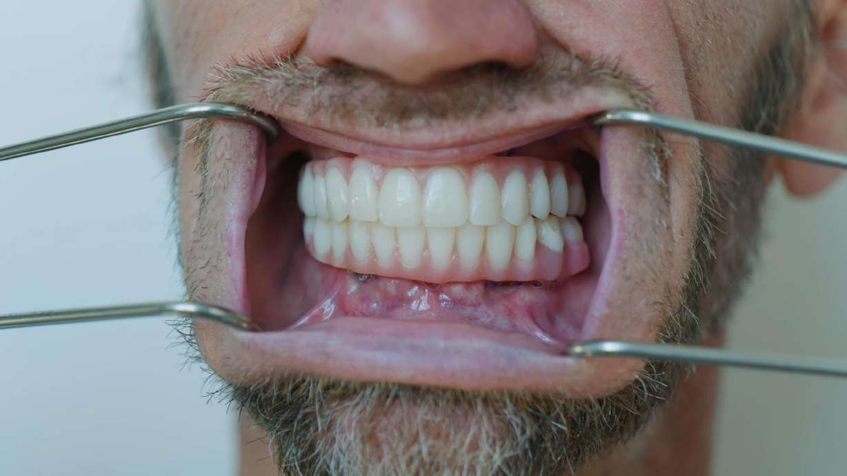 Utah man's trip to Mexico for dental implants cost him more than just money