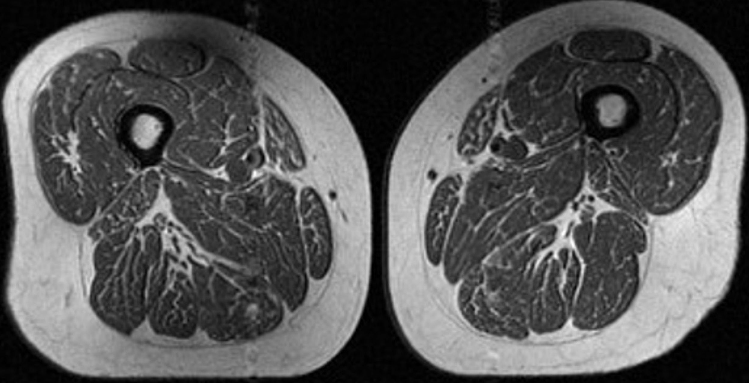 Top U.S. story anchor