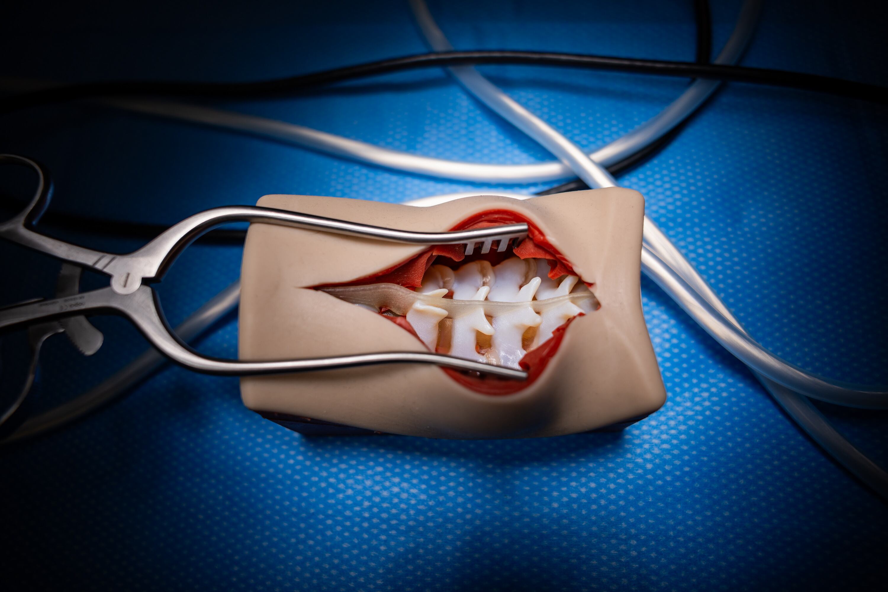 A 3D-printed spine made by Fusetec in the ASCENT Surgical Lab during a formal dedication event at the James Levoy Sorenson Center for Medical Innovation in Salt Lake City on Tuesday. The nearly 60,000-square-foot, four-level center is designed to accelerate medical research, medical device development and life sciences training.