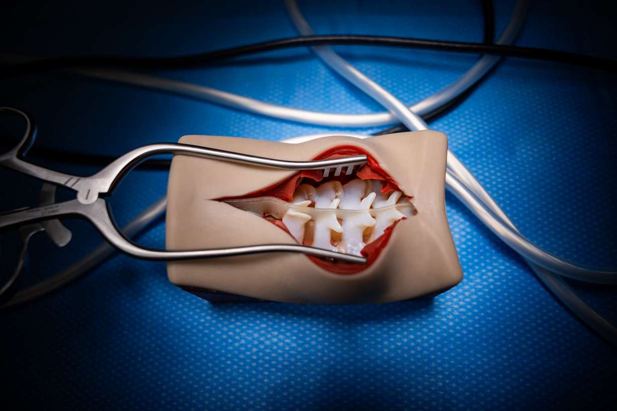 A 3D-printed spine made by Fusetec in the ASCENT Surgical Lab during a formal dedication event at the James Levoy Sorenson Center for Medical Innovation in Salt Lake City on Tuesday. The nearly 60,000-square-foot, four-level center is designed to accelerate medical research, medical device development and life sciences training.