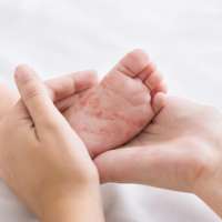 Learning from the measles outbreak: The importance of effective health administration