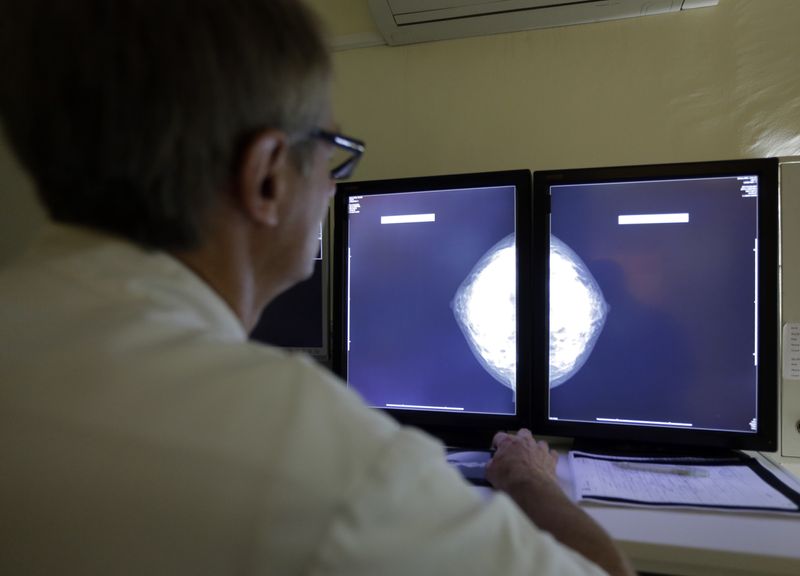 Genomic testing improves treatment, survival for Black breast cancer patients