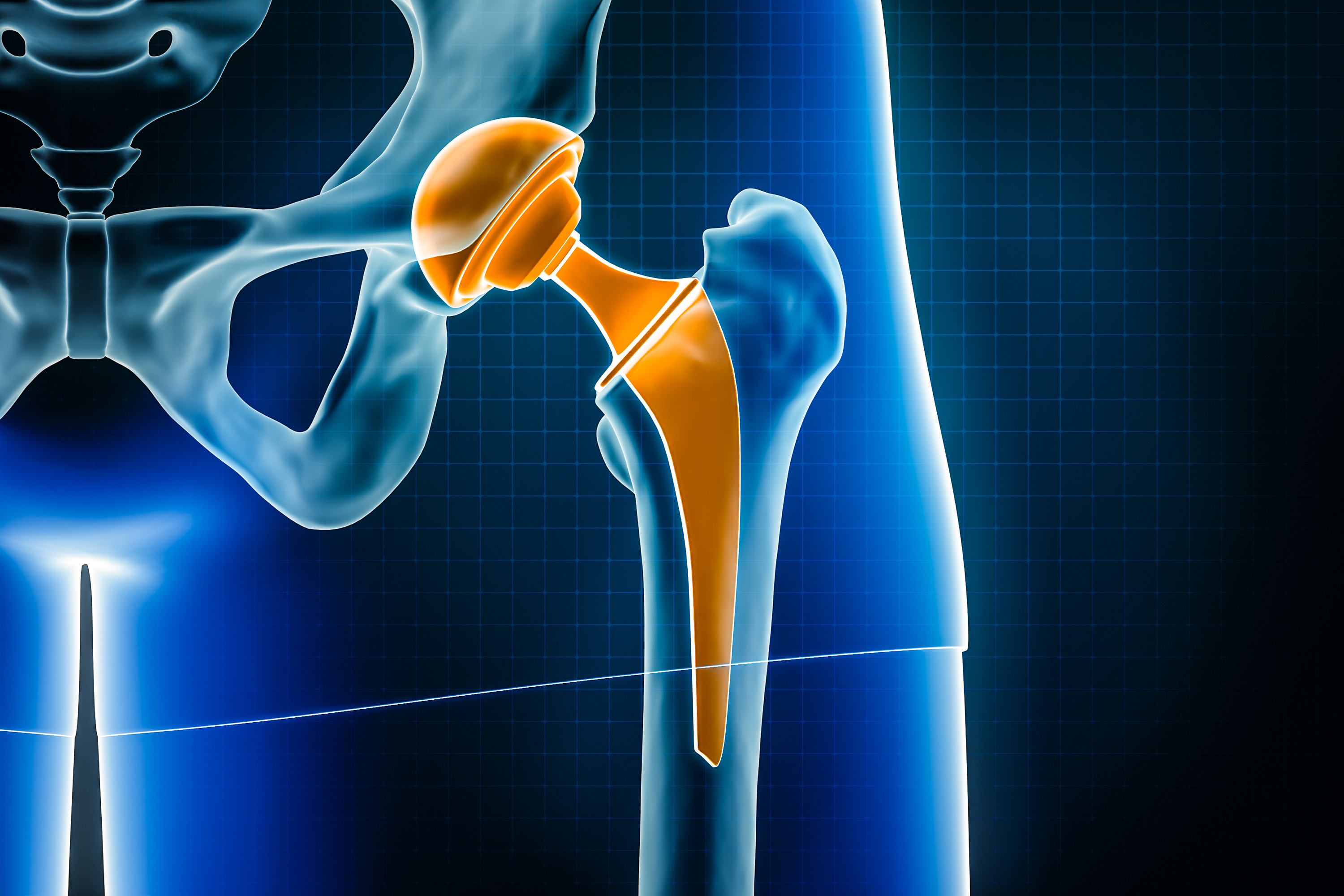 Rapid recovery revolution: How modern joint replacement is changing lives