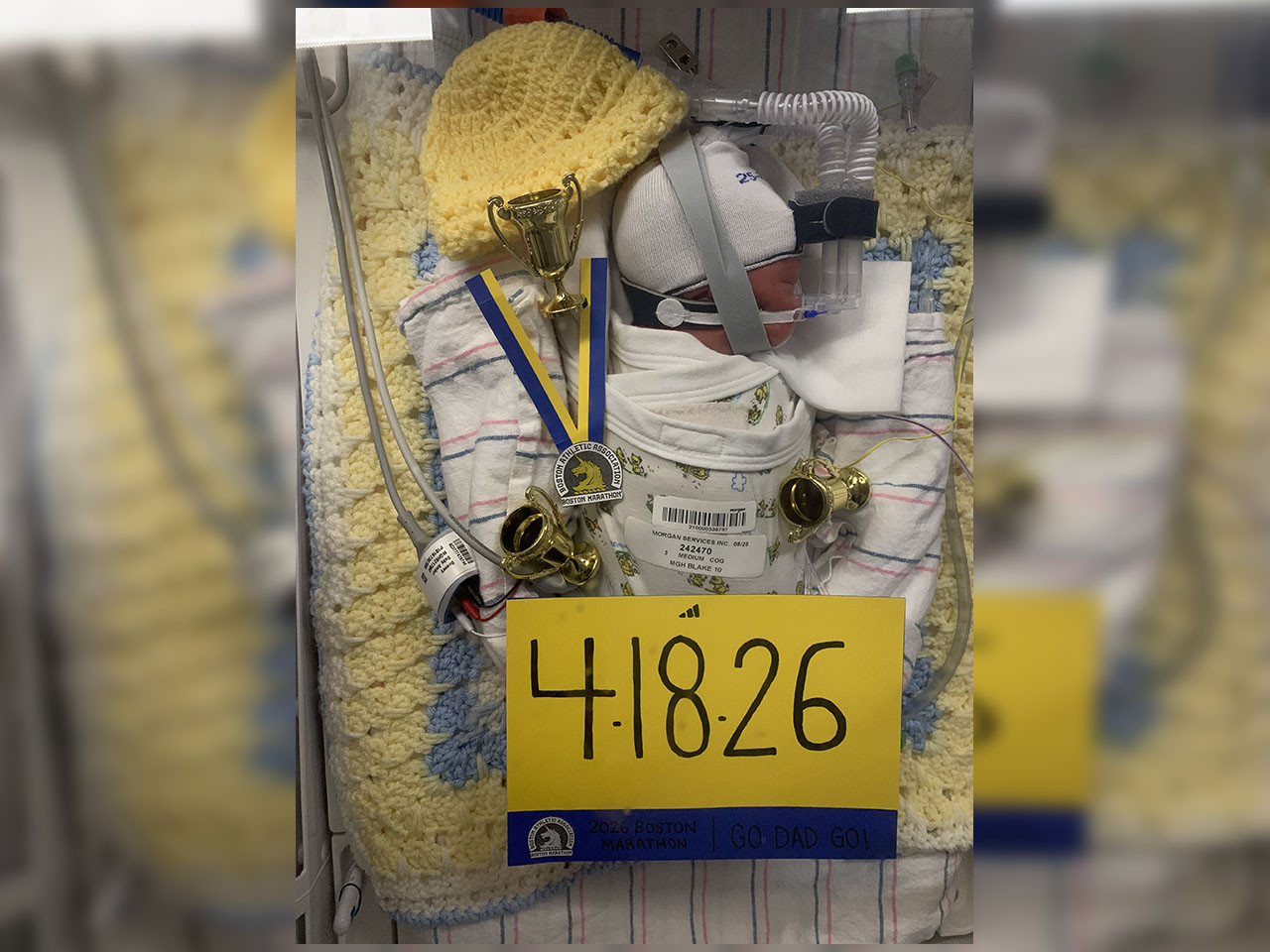 A Lehi family has had an extended stay at a hospital in Boston due to the unexpected early arrival of their second son, James, who was born a couple of days before his dad was set to race the Boston Marathon. James was born at 30 weeks 4 days of gestation and will need to remain in the NICU in Boston for the next couple of months.