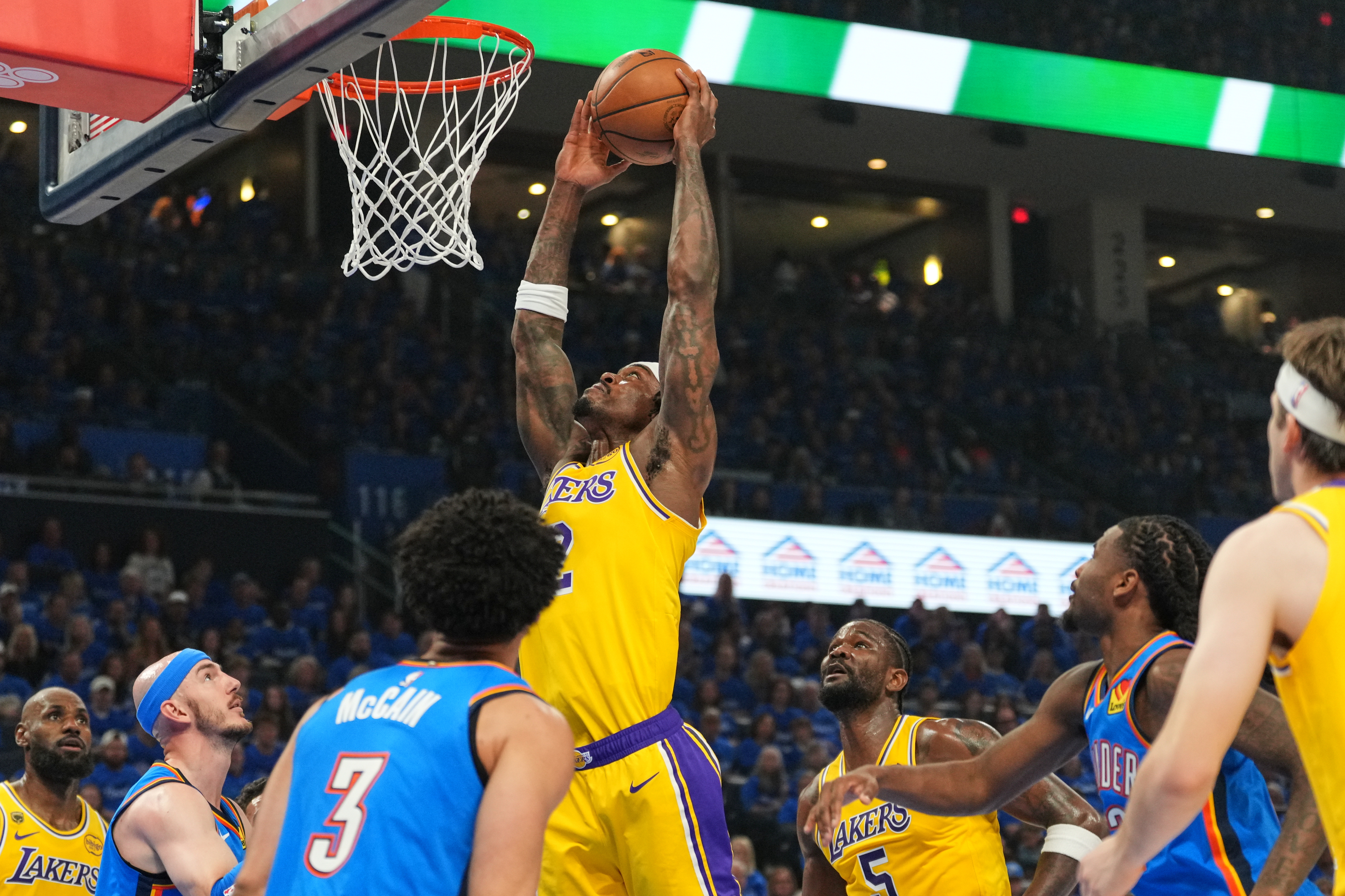 Lakers forward Vanderbilt suffers 'gruesome' injury to right pinkie while trying to block shot