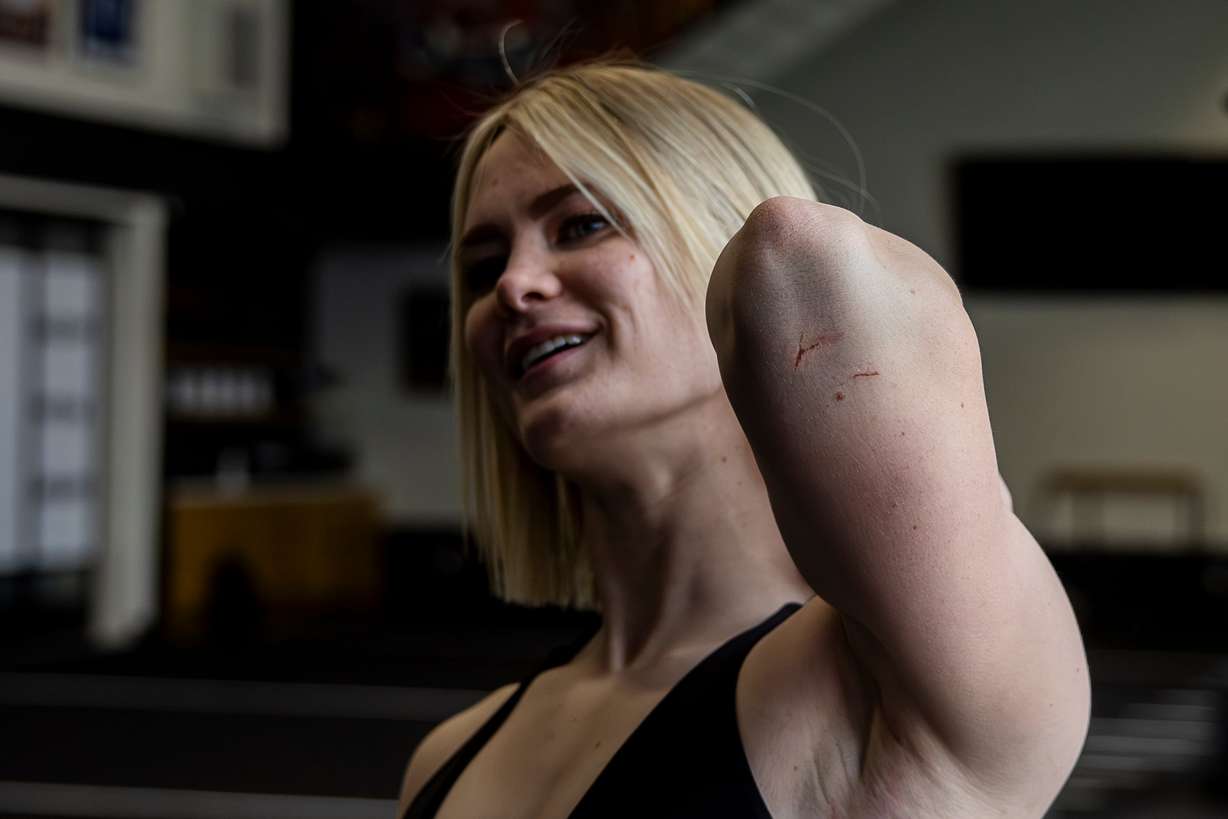 Katelynn Olson shows off some scrapes from a stunt during a workout at P1 Athlete in Lehi on May 17. Stunt performers are expected to be in great shape in order to perform properly.