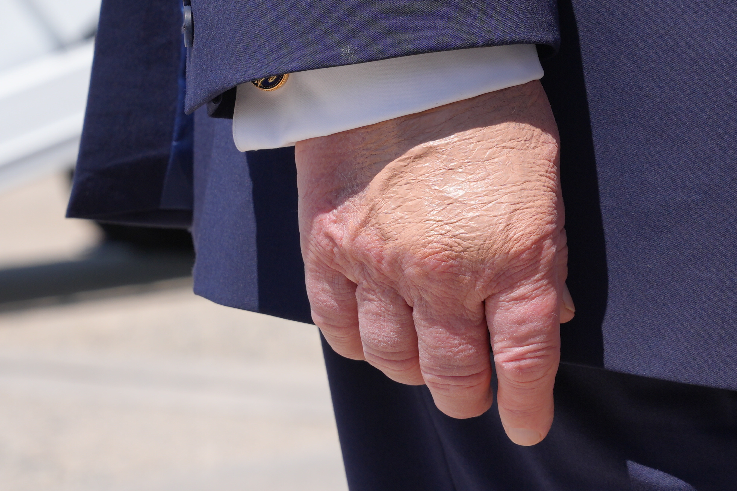 President Donald Trump's right hand as he speaks to the press after returning and stepping off Air Force One, Wednesday, at Joint Base Andrews, Md., after speaking at the U.S. Coast Guard Academy commencement. Trump's hands are often covered in makeup to conceal bruising.
