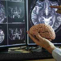 Improved hearing can lower risk of dementia and improve overall health