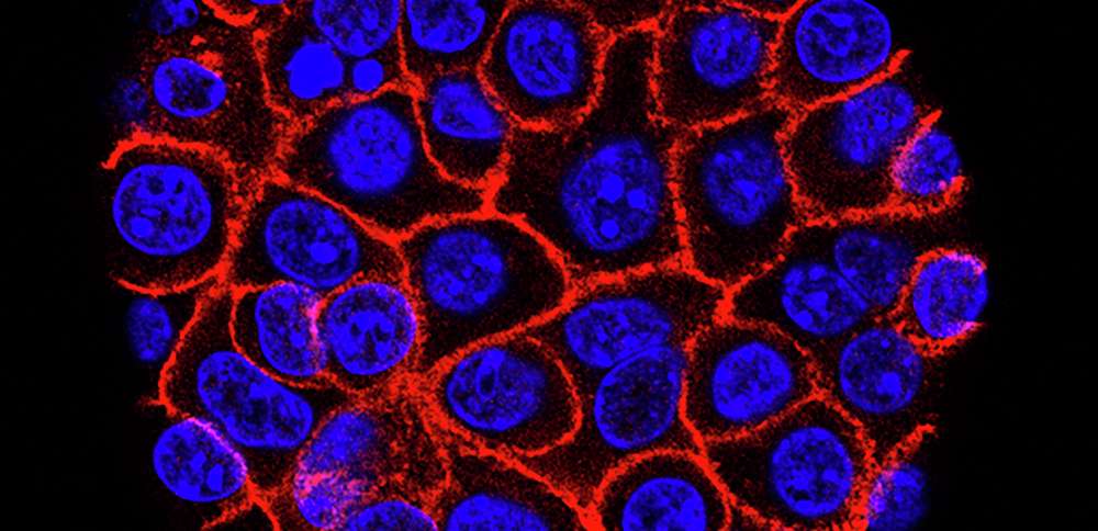 Experimental pill promises new hope for deadly pancreatic cancer