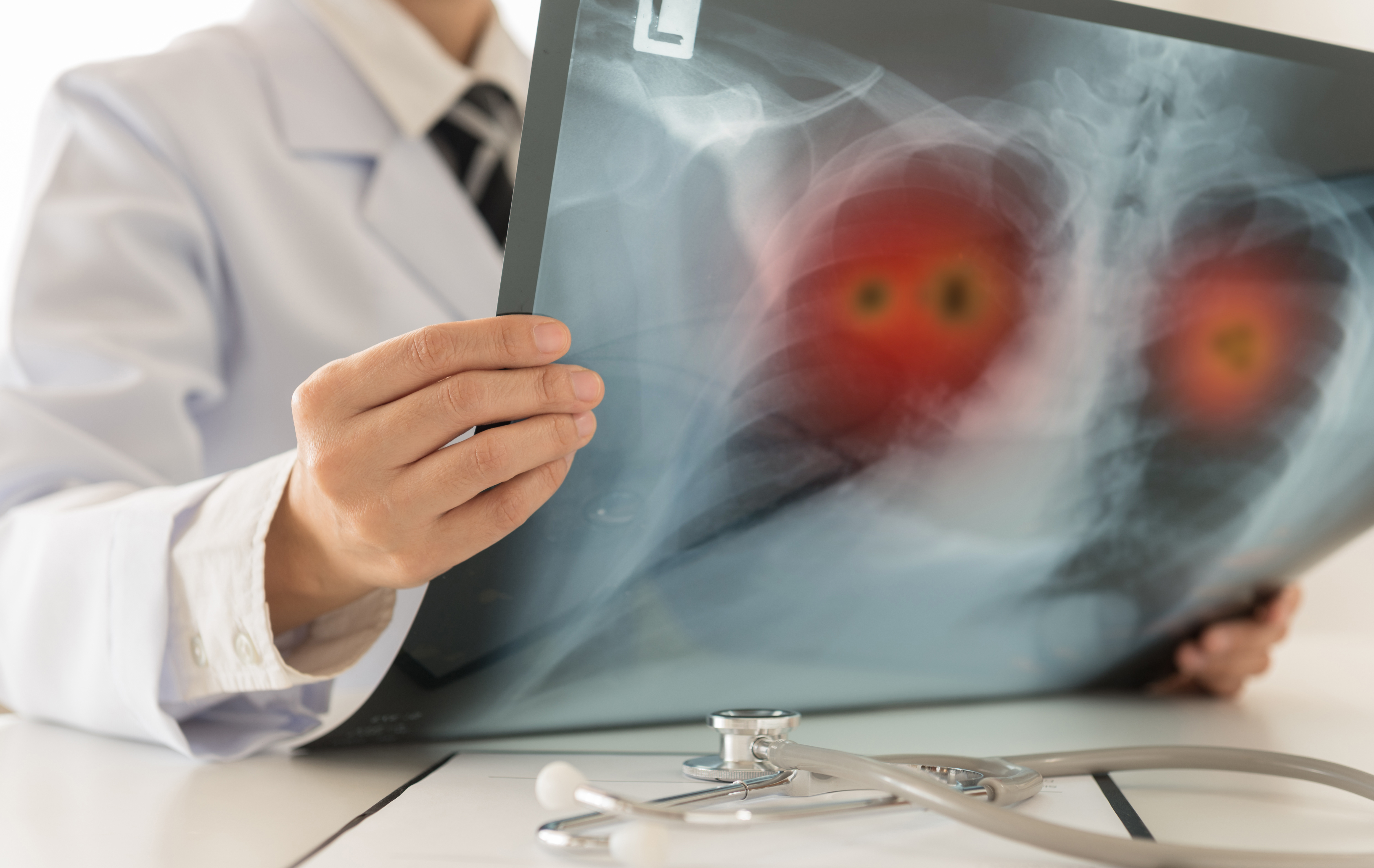 Survivor, advocate: Inexpensive radon test can head off lifelong lung cancer battle