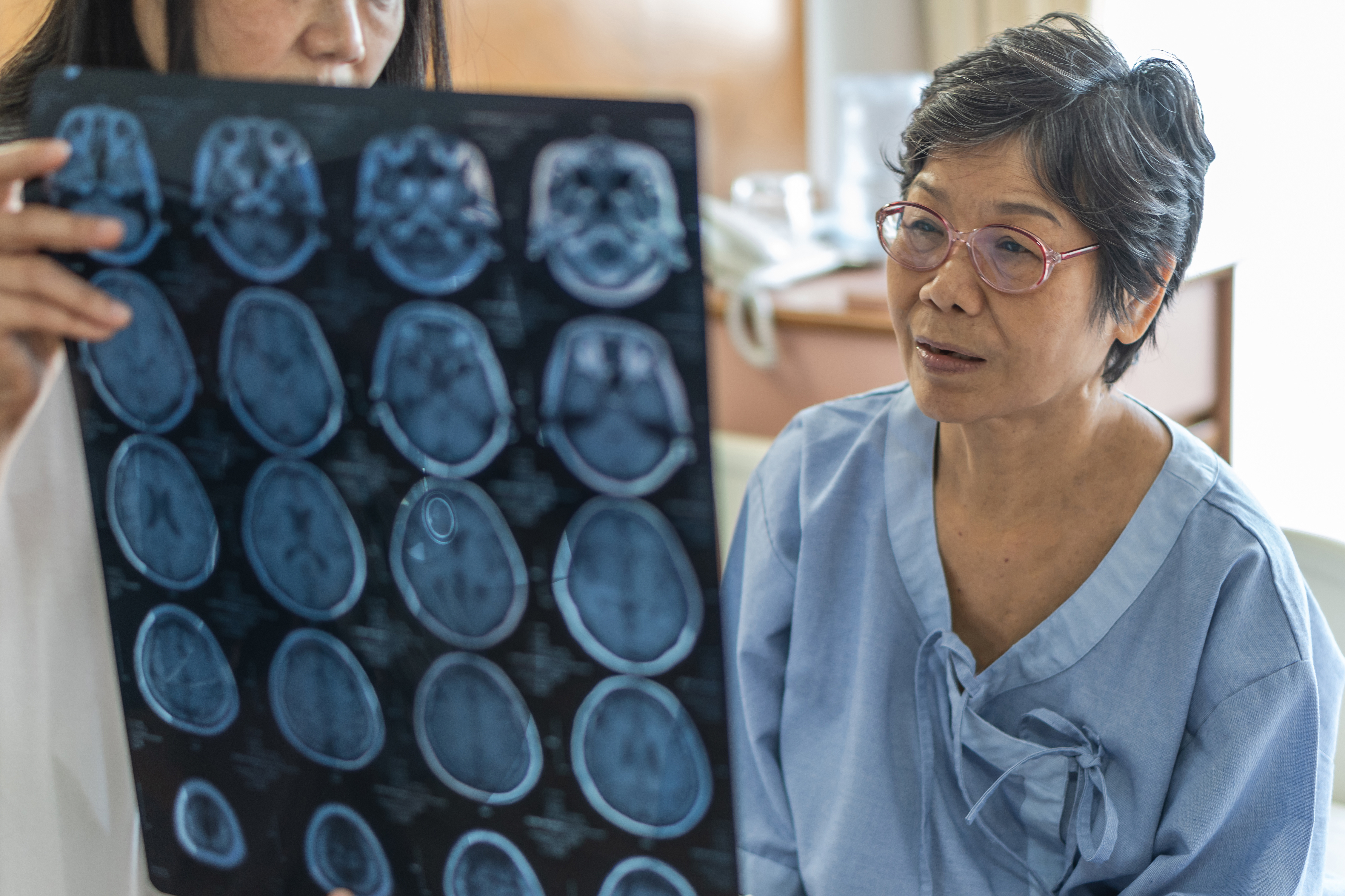 How to recognize signs of a stroke and act as soon as possible