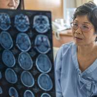 How to recognize signs of a stroke and act as soon as possible