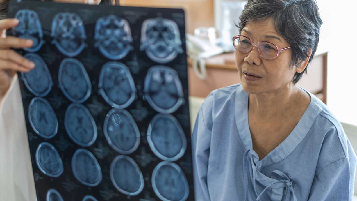 How to recognize signs of a stroke and act as soon as possible - KSL News