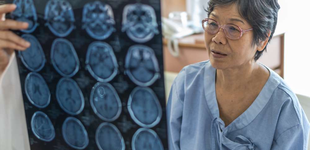 How to recognize signs of a stroke and act as soon as possible