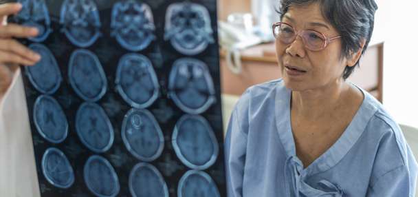 How to recognize signs of a stroke and act as soon as possible