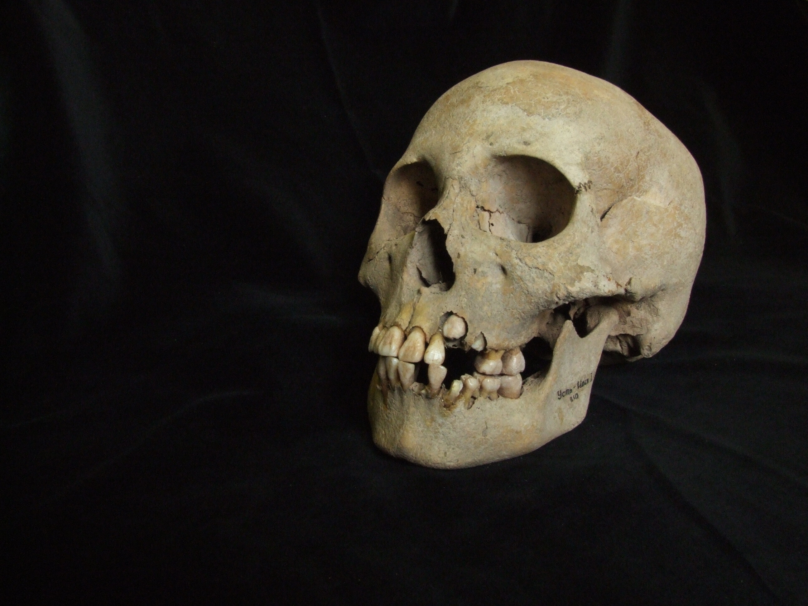 This 2006 image from Angela Lieverse shows the skull of a young girl who was buried with victims of the plague in Siberia. Scientists have found the oldest known evidence of the plague.