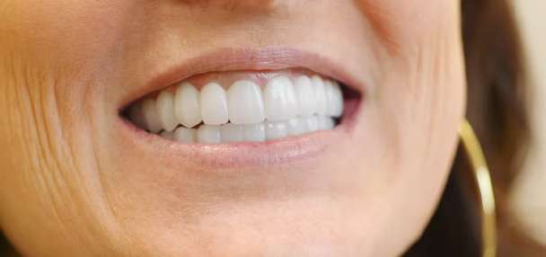 4 critical implant questions Utah dentists are avoiding