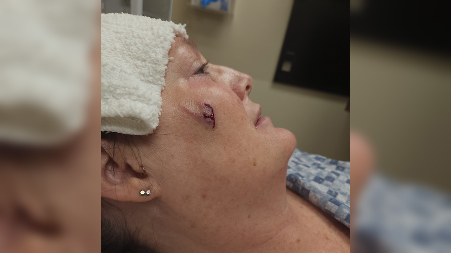 Dog viciously attacks owner after fireworks, experts warn to look for the signs
