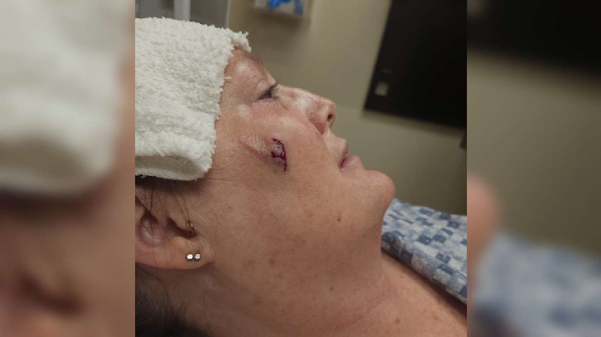Dog viciously attacks owner after fireworks, experts warn to look for the signs