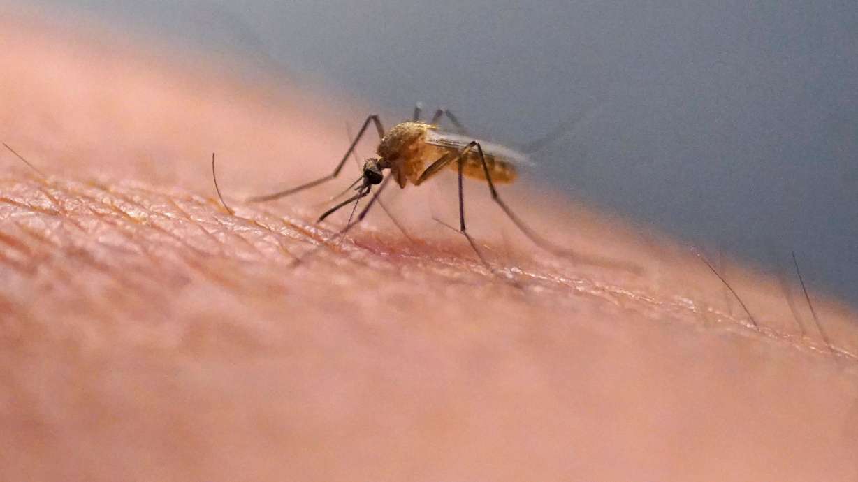 Researchers now have a better understanding of why even a mildly annoying itch could put you on an itch-and-scratch cycle if you give in.