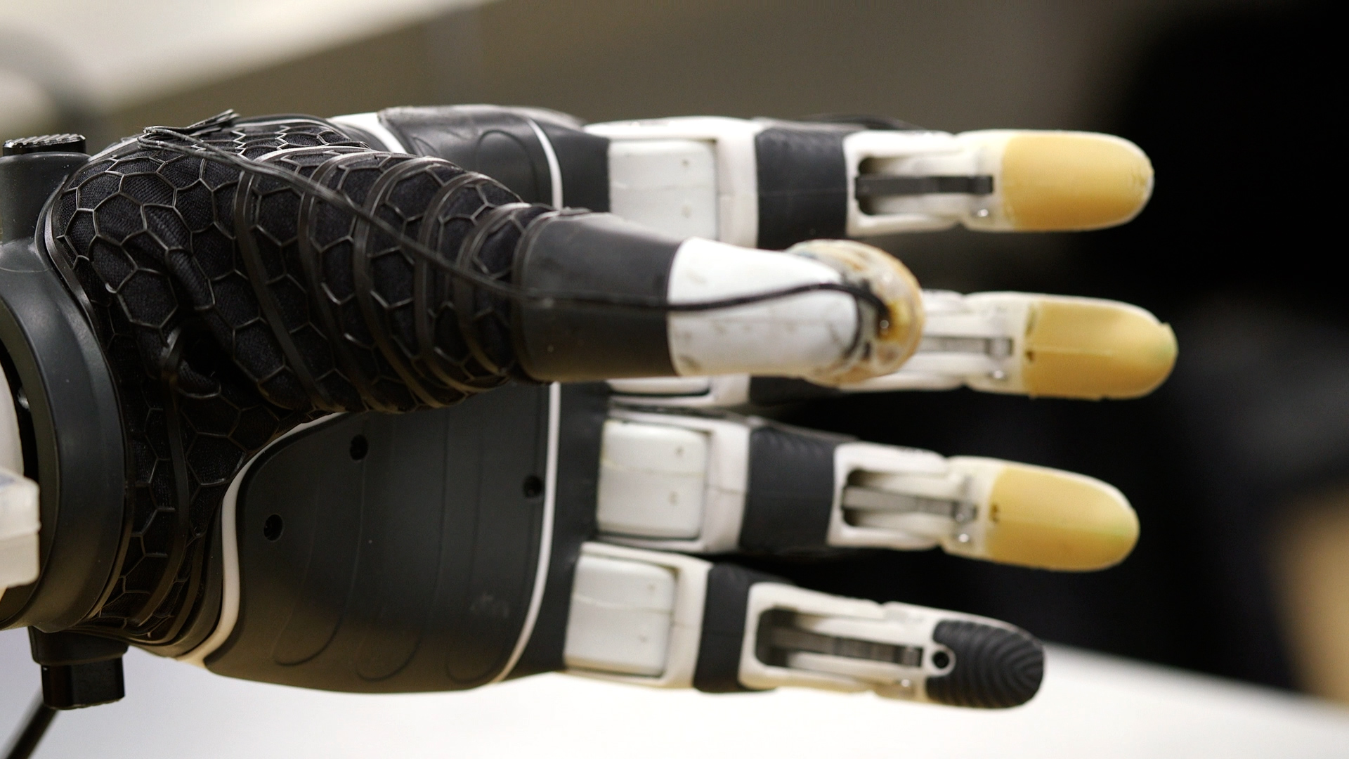 The retrofitted bionic hand.