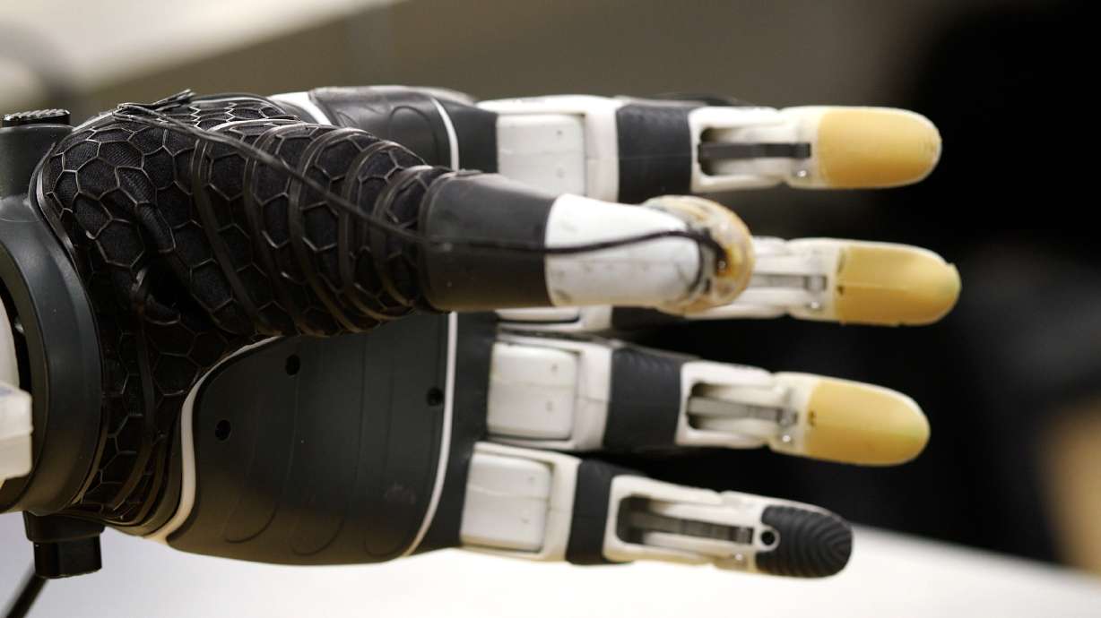 The retrofitted bionic hand.