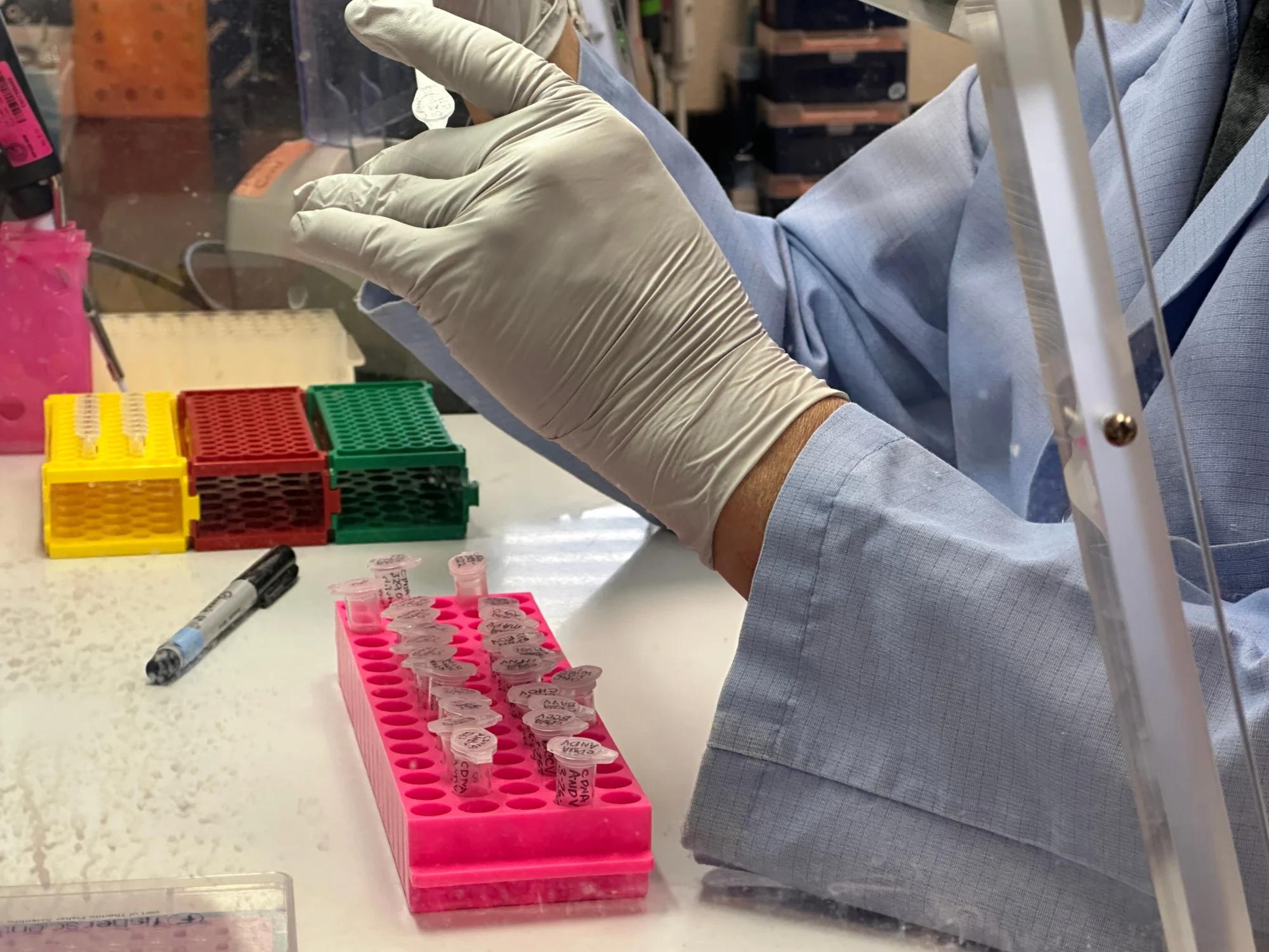 What to know about hantavirus, the illness suspected in a cruise ship outbreak