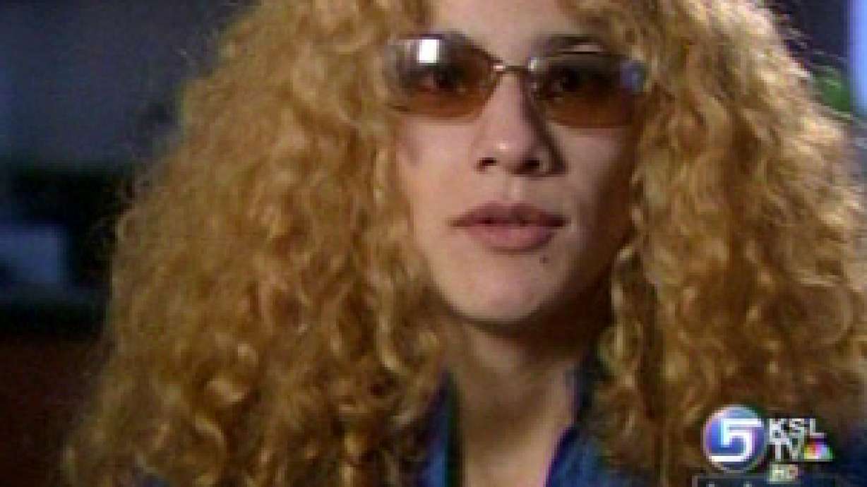 Woman blames salon for chemically-burned scalp