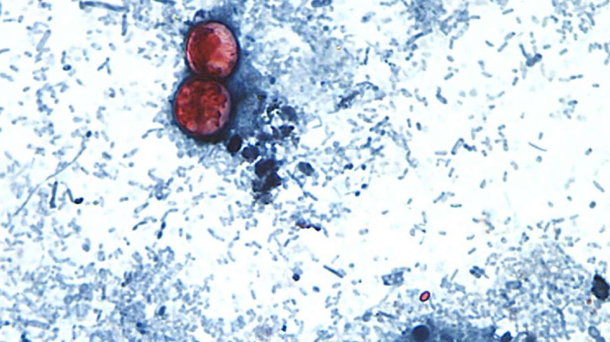 Cyclosporiasis is an intestinal infection caused by the cyclospora cayetanensis parasite. Illness is caused by consuming food or drink that contains the parasite. It usually takes about a week to make a person sick.