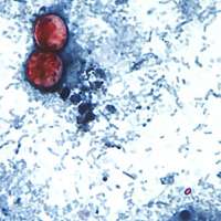 Utah-based lab helps track cyclospora outbreak as cases rise nationwide
