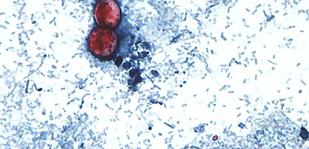 Utah-based lab helps track cyclospora outbreak as cases rise nationwide