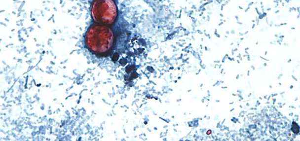 Utah-based lab helps track cyclospora outbreak as cases rise nationwide