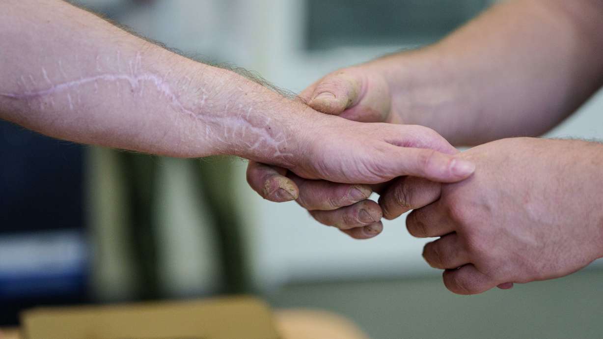 Ivan Shostak, right, a blind Ukrainian war veteran touches an injured arm of his comrade during a pottery workshop at a rehabilitation center in Vinnytsia, Ukraine, on May 21, 2026.