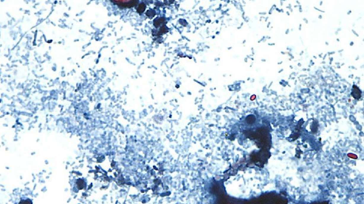 Two people in Michigan have died in connection with the outbreak of cyclosporiasis, health officials reported Monday.