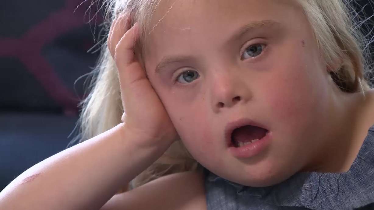 Lyddie, 6 years old, is pictured in her home on Monday. Thirty-six years after the Americans with Disabilities Act became law, disability advocates in Utah say the landmark civil rights legislation has transformed lives, but significant work remains.