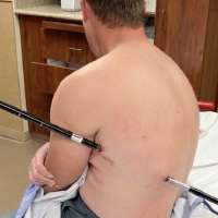 Man impales himself on trekking pole, hikes 10 miles down Montana's tallest mountain with it still in body
