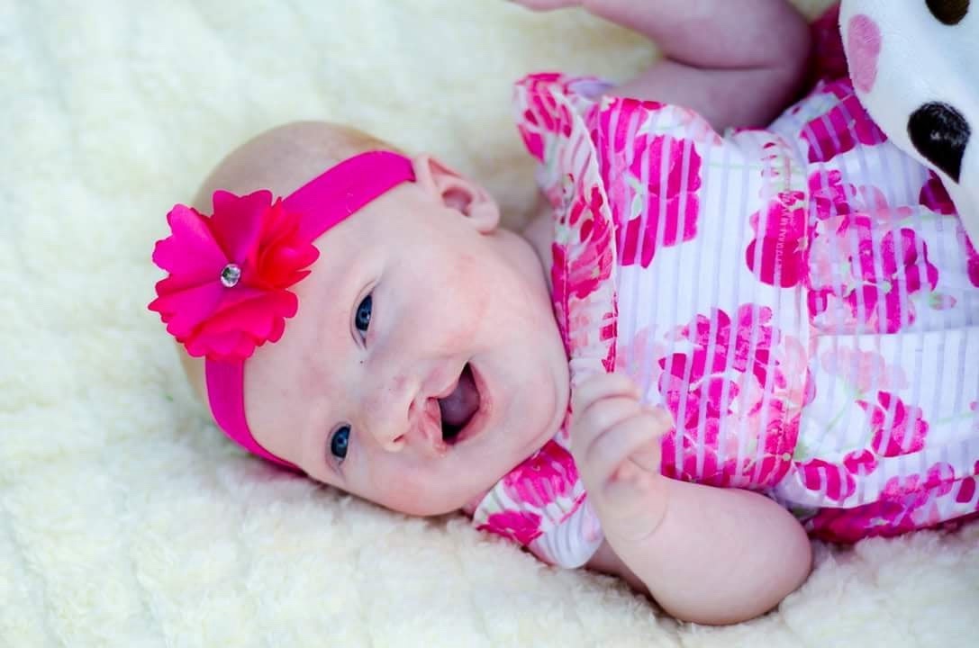 Mother and daughter navigate cleft lip and palate journey together