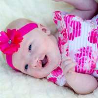 Mother and daughter navigate cleft lip and palate journey together