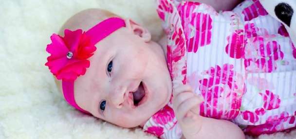 Mother and daughter navigate cleft lip and palate journey together