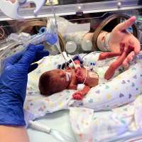 Ogden Regional Medical Center NICU expansion to bring more beds, support for families