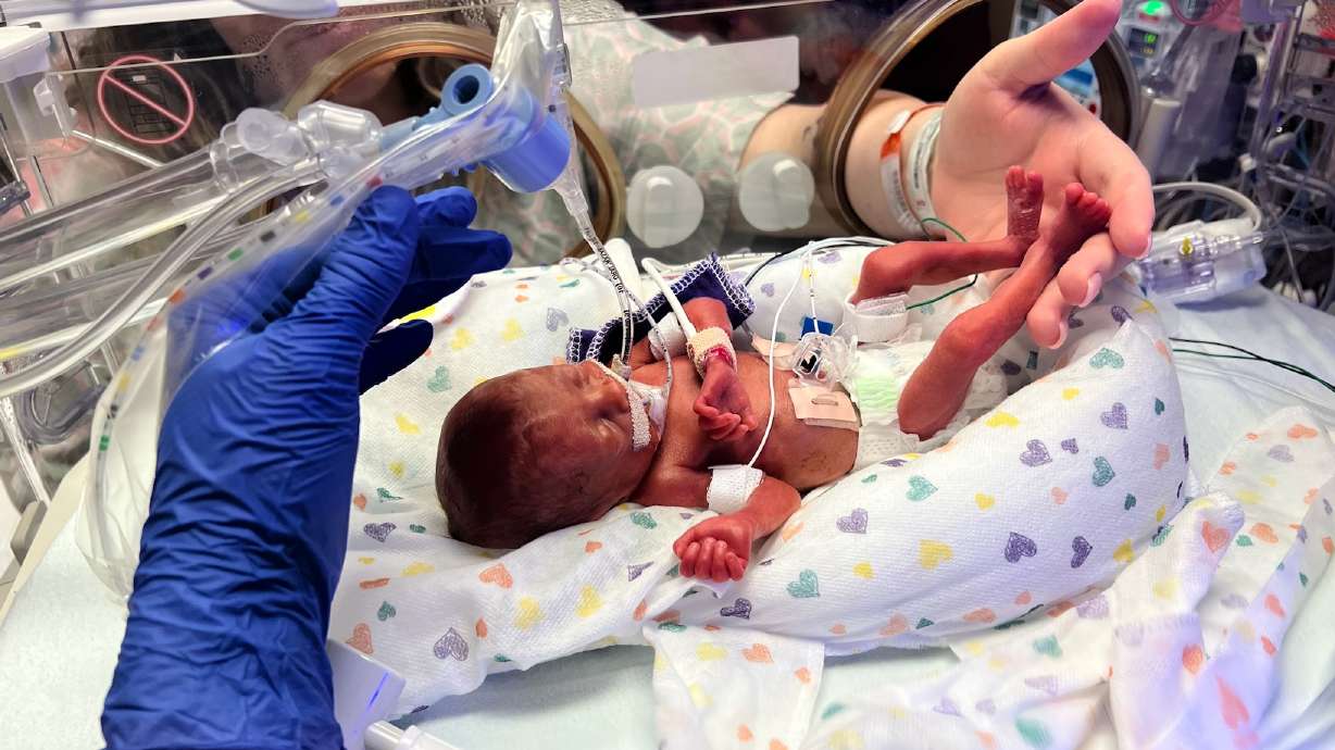 Charlotte Cardamone was born at a little more than 23 weeks. She's being treated as Ogden Regional Medical Center's NICU, which is undergoing a renovation and expansion